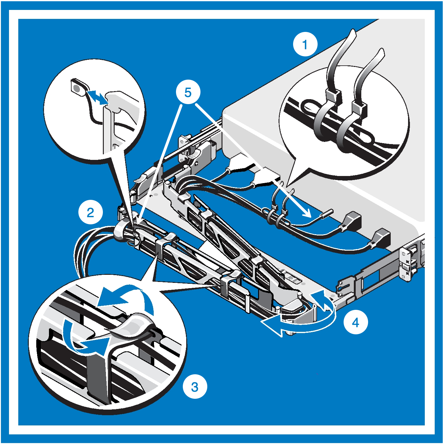 Illustration av CMA med kablar installerade